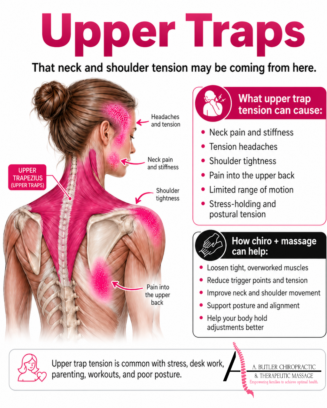 Upper Trap Tension: Why Your Neck and Shoulders Feel So Tight