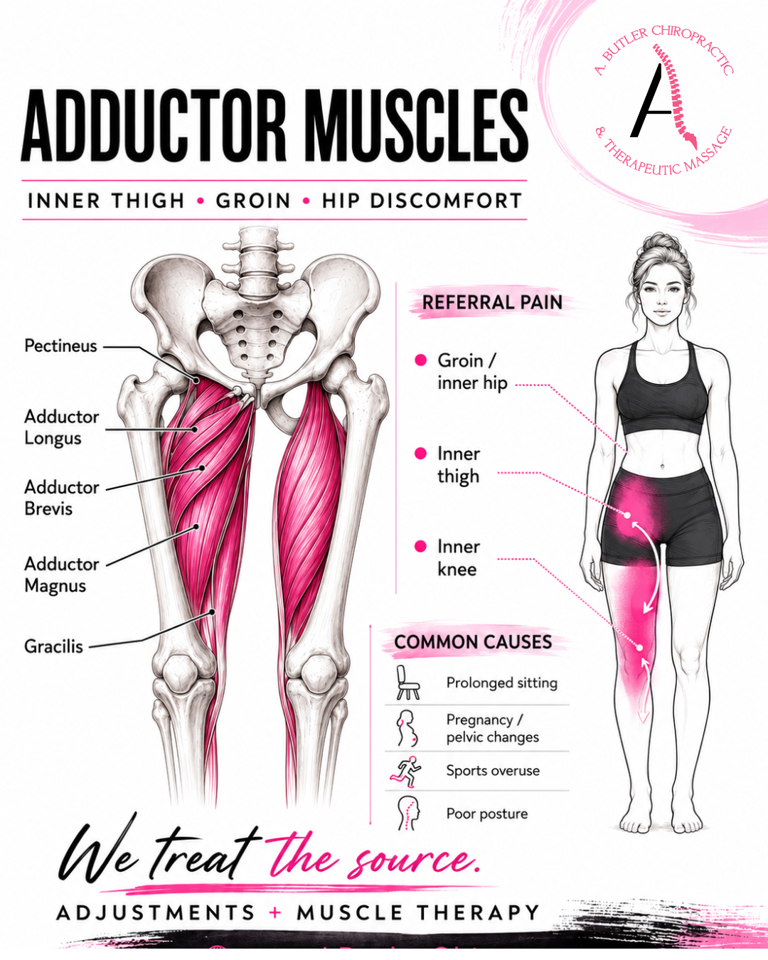 Adductor Magnus Pain: Could This Inner Thigh Muscle Be Causing Hip, Groin, or Knee Pain?