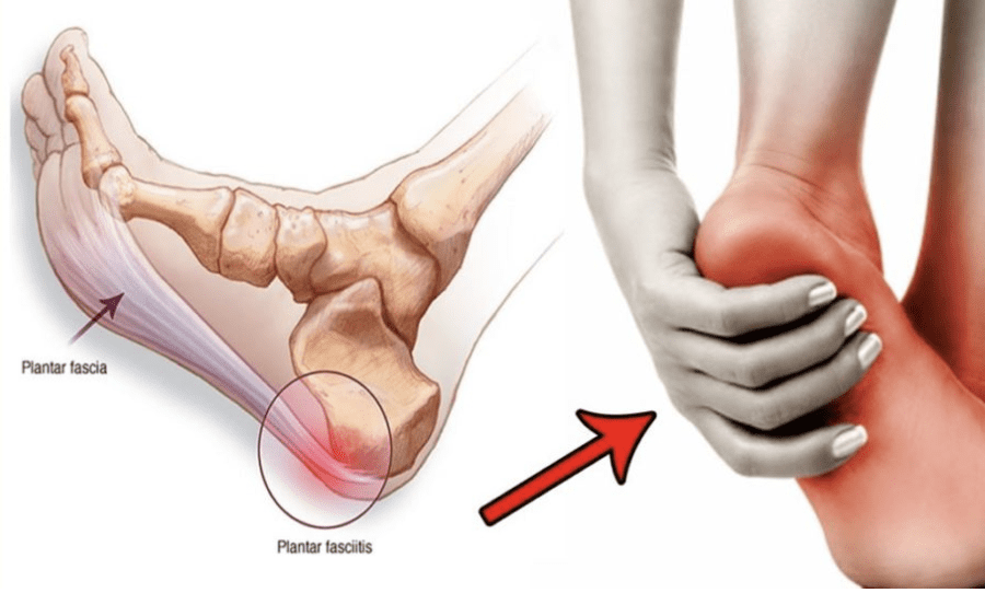 Pain in heel of foot after sitting on sale