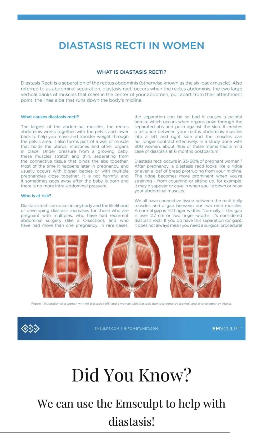 EMSCULPT NEO for Diastasis Recti — West Em Medical Spa
