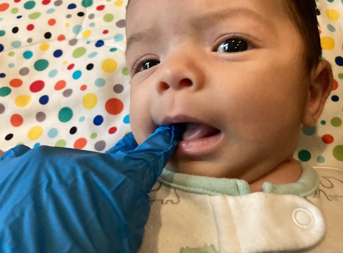 Oral motor therapy- baby is doing 👅tongue exercises to help get a better latch on breast. 

If you hear clicking during breast/bottlefeeding or baby isn&rsquo;t able to sustain latch, Seek support from a lactation specialist, we can help you reach y