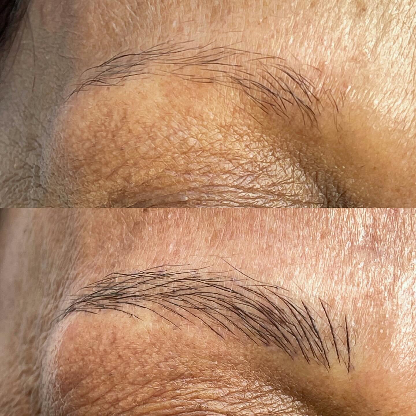 ✨First session of building these brows. More density and shape but still natural✨💕

Go to link in bio to book your appointment🖤

⏳Length of appointment: 2.5- 3 hours 
❤️&zwj;🩹Pain level: 2 topical numbing agents used to ensure your comfort 
🩹Heal