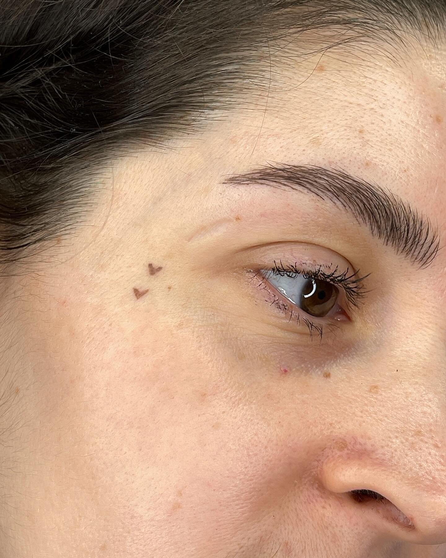 ✦HEALED heart freckles🤎🤎 
In love with these, please come get hearts😍

✨TO BOOK GO TO LINK IN BIO✨

🤍You can always add a freckle session or just a heart to your microblading appointment 
🤍Heart freckles can go anywhere, not just your face 
🤍Al