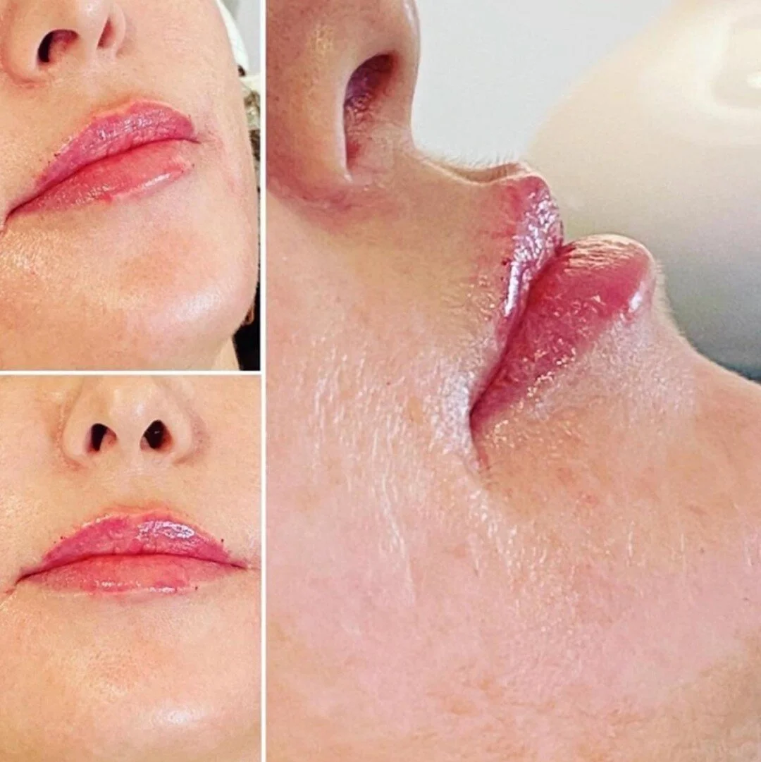 Love a pretty, plump lip 👄 Why wait? Book your appointment today. Link in bio.