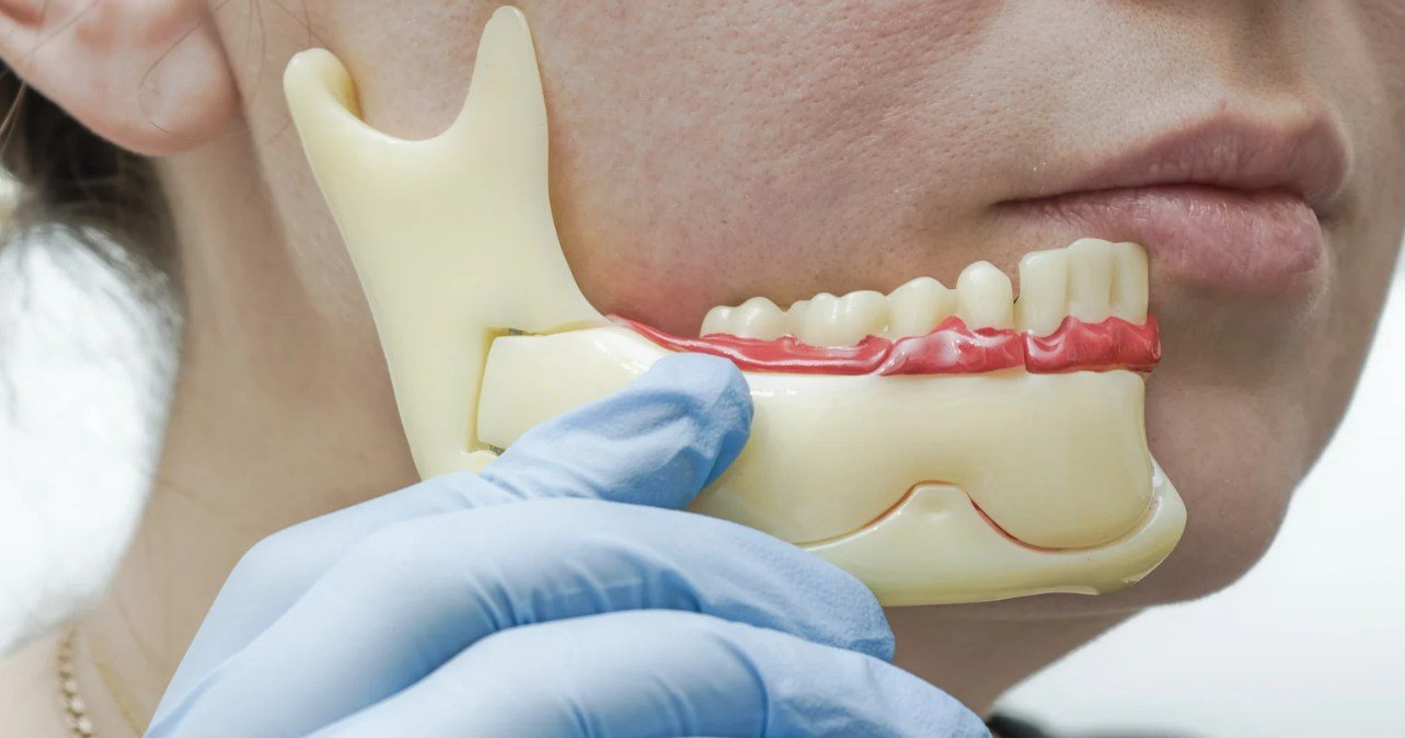 Beyond the Mouthguard: A Clinical Guide to Relieving TMJ and Jaw Tension in Edmonton