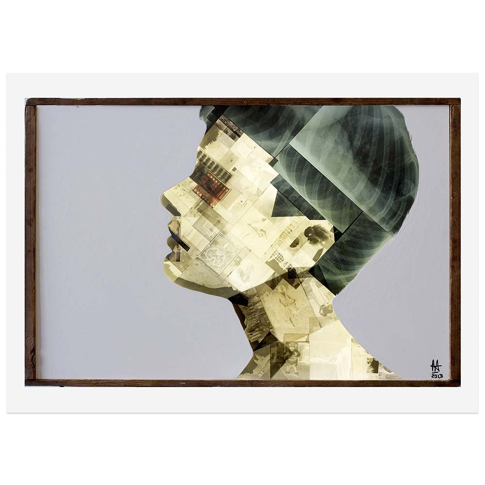 X ray and film negative collage