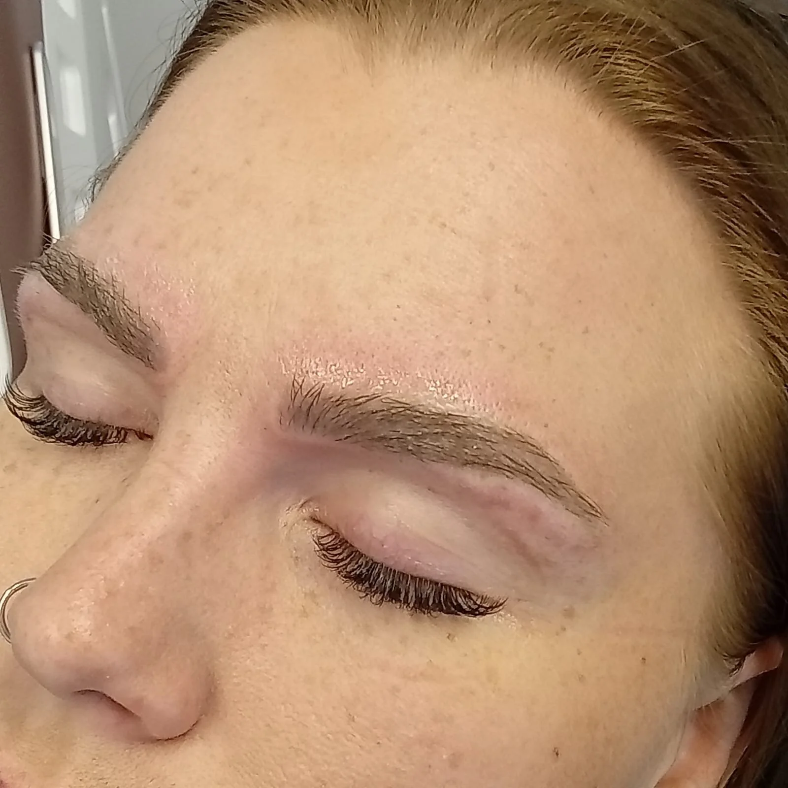 Kosmeettinen tatuointi kulmissa tatuoinninpoiston jälkeen.