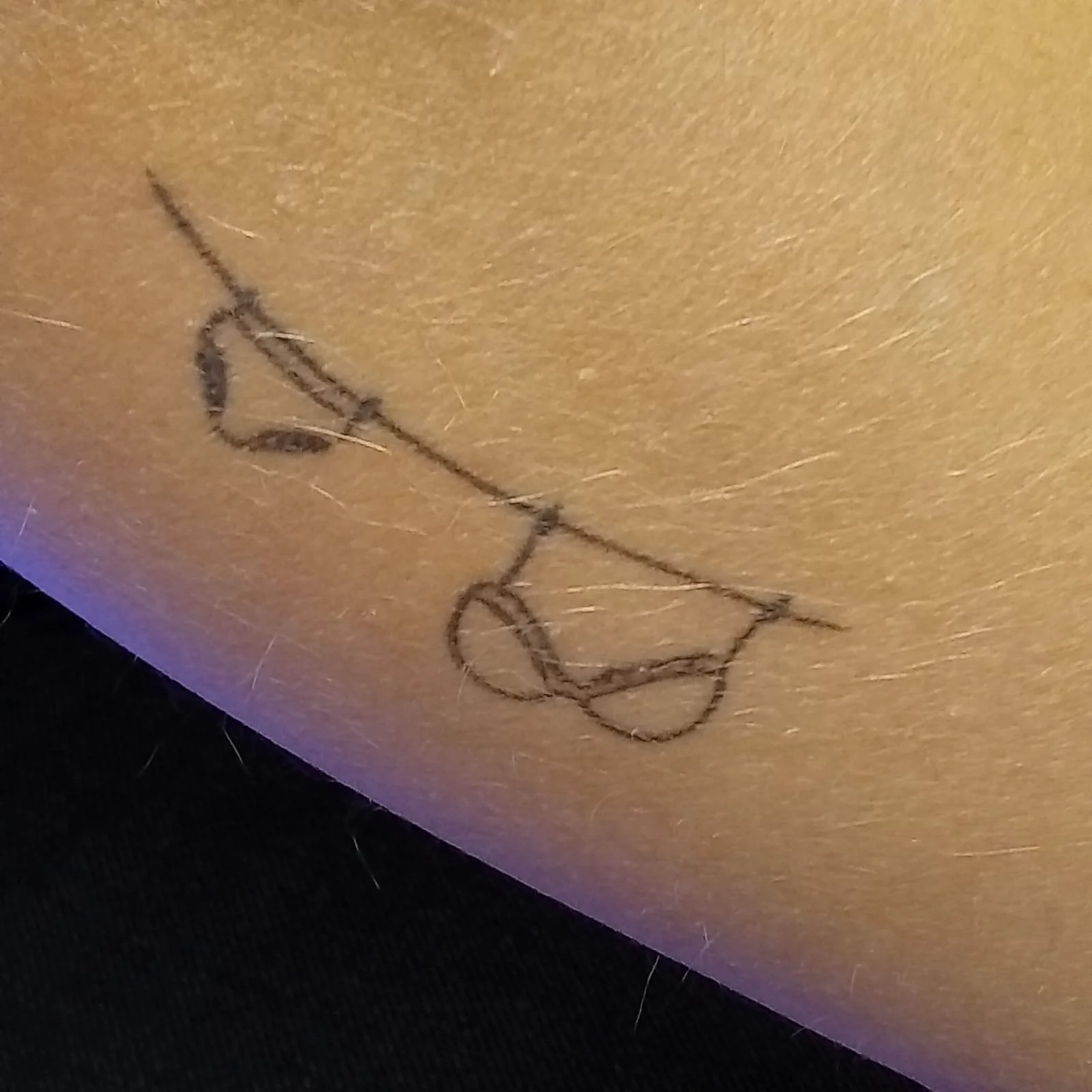 Tatuointi käsivarressa ennen tatuoinninpoistoa.
