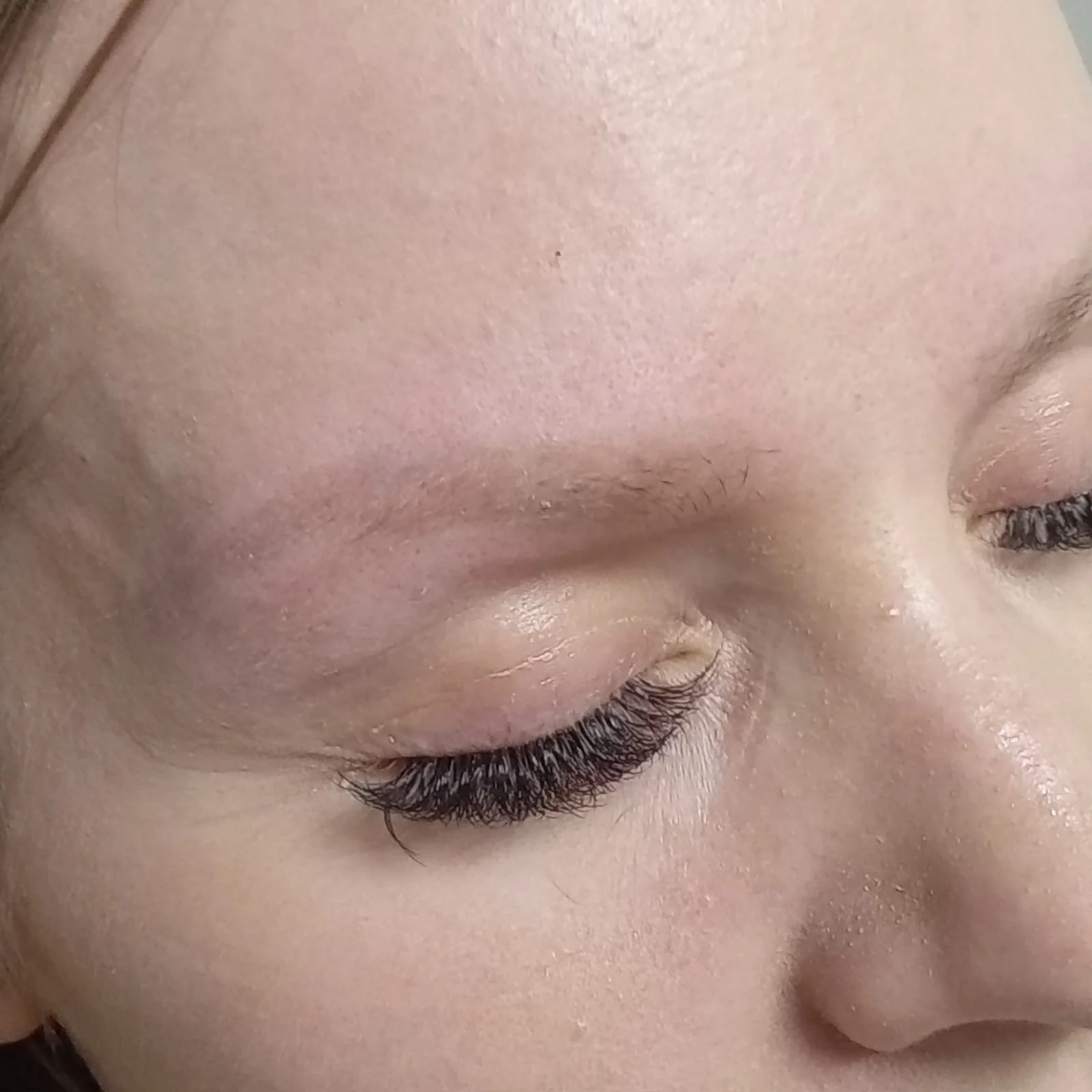 Kosmeettinen tatuointi kulmissa tatuoinninpoiston jälkeen.