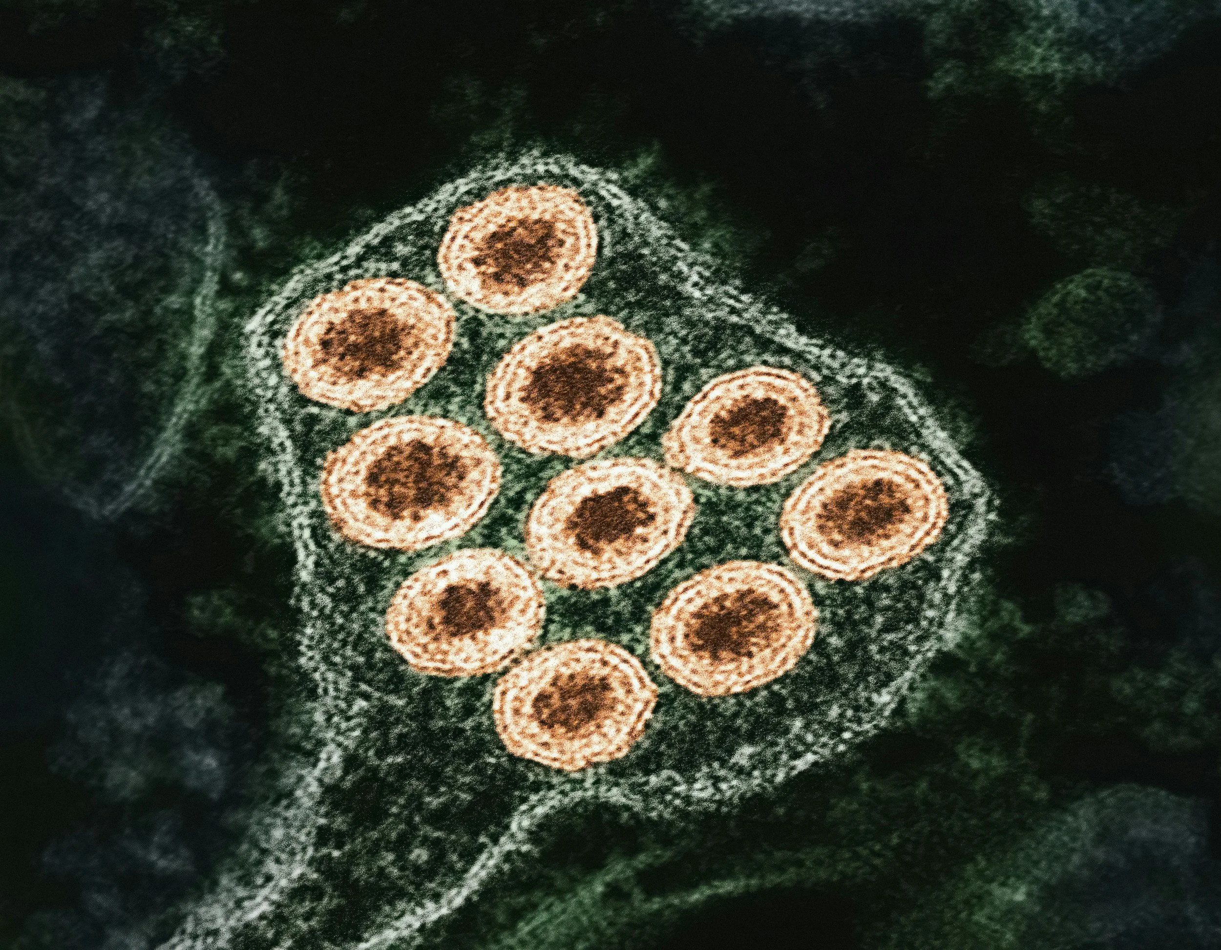 Colorized electron micrograph of rabies virus particles