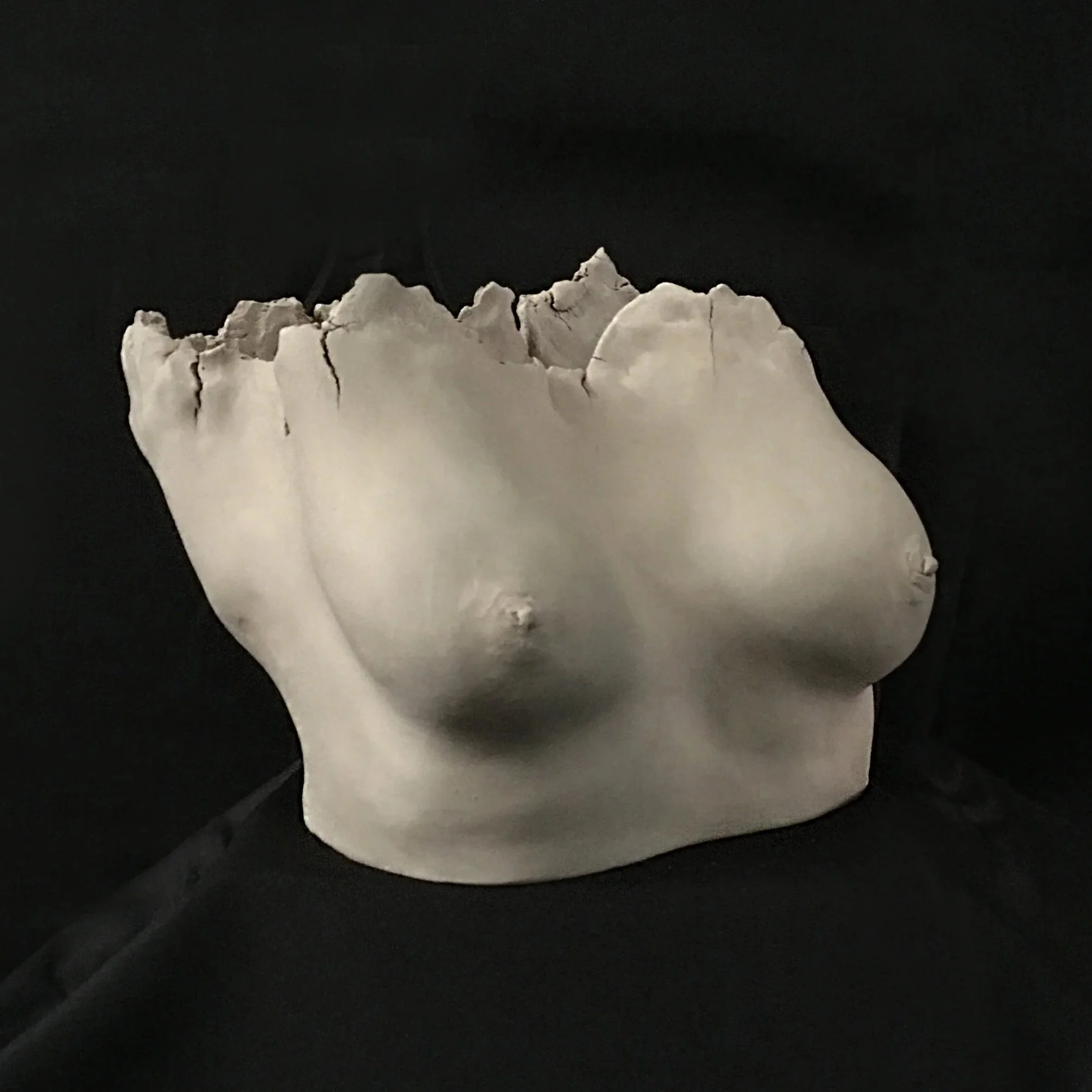 Close-up of a damaged, cracked white skull bone on a black background.