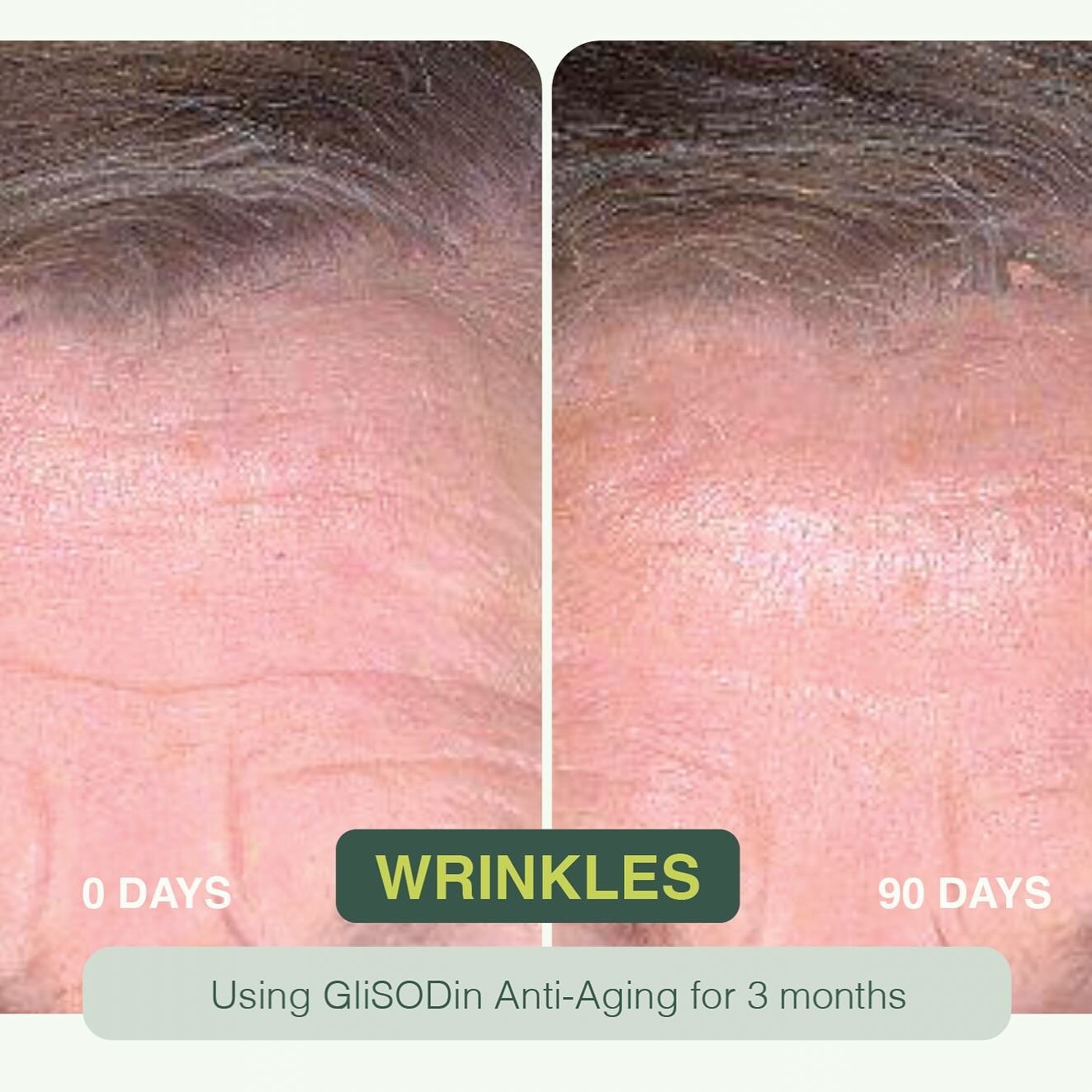 Glisodin Anti Age supplements are clinically proven to to protect the skin from signs of aging with the help of effective antioxidants and moisturising ingredients.

Read the study summary.  Blog link in our bio.

#glisodin #antiage #sodenzyme #gliad
