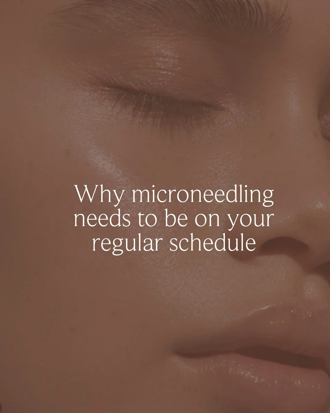 Consistency is where the magic happens ✨⁠
⁠
Microneedling isn&rsquo;t a one-time fix &mdash; it&rsquo;s a long-term strategy for glowing, healthy skin. Most of our clients book every 4&ndash;6 weeks and pair their treatments with facials and custom h