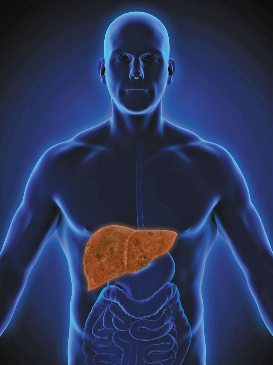 p6_NAFLD-liver_HH1908_gi656975240(1).jpg