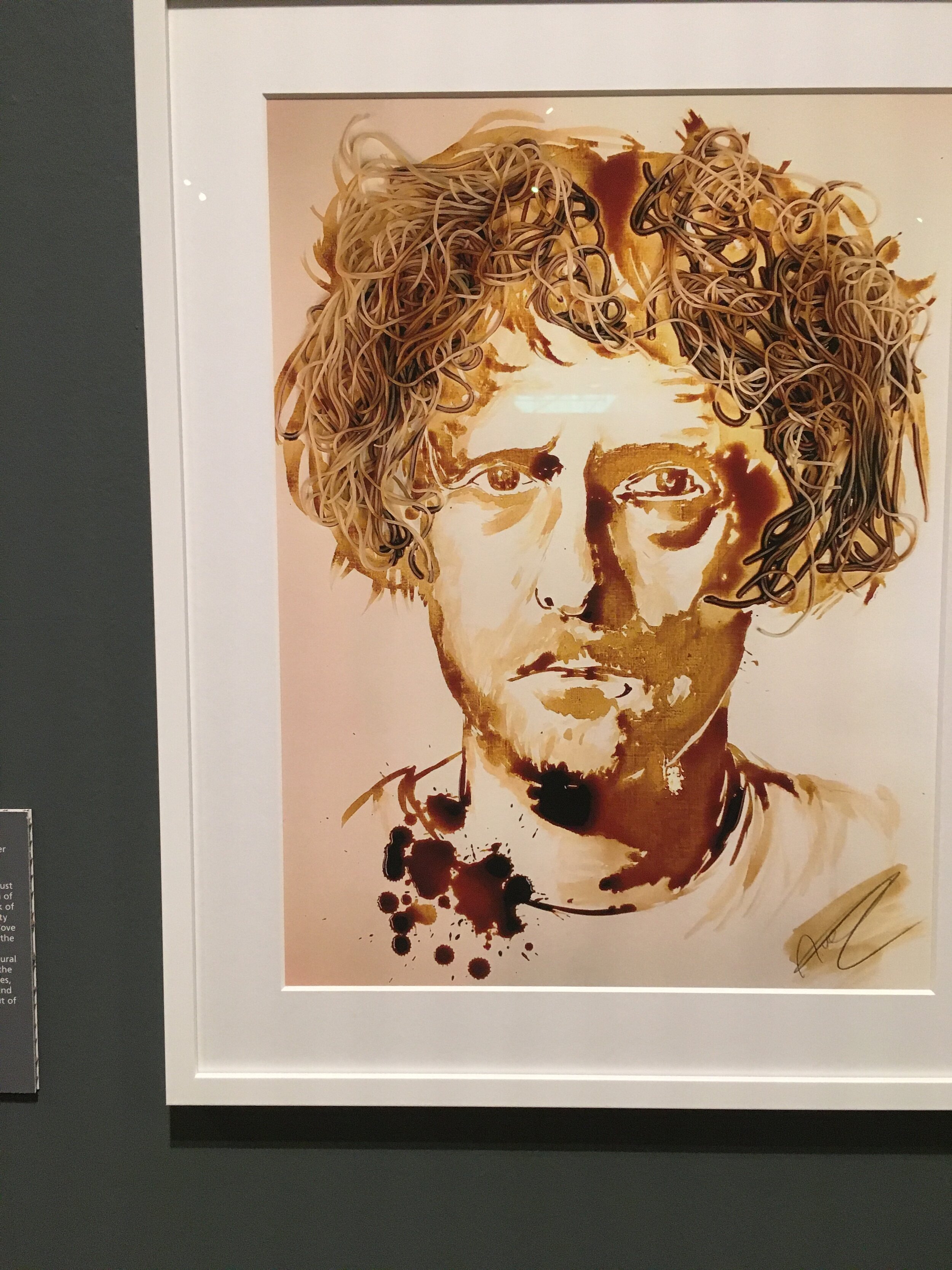 Alan_measles.JPG