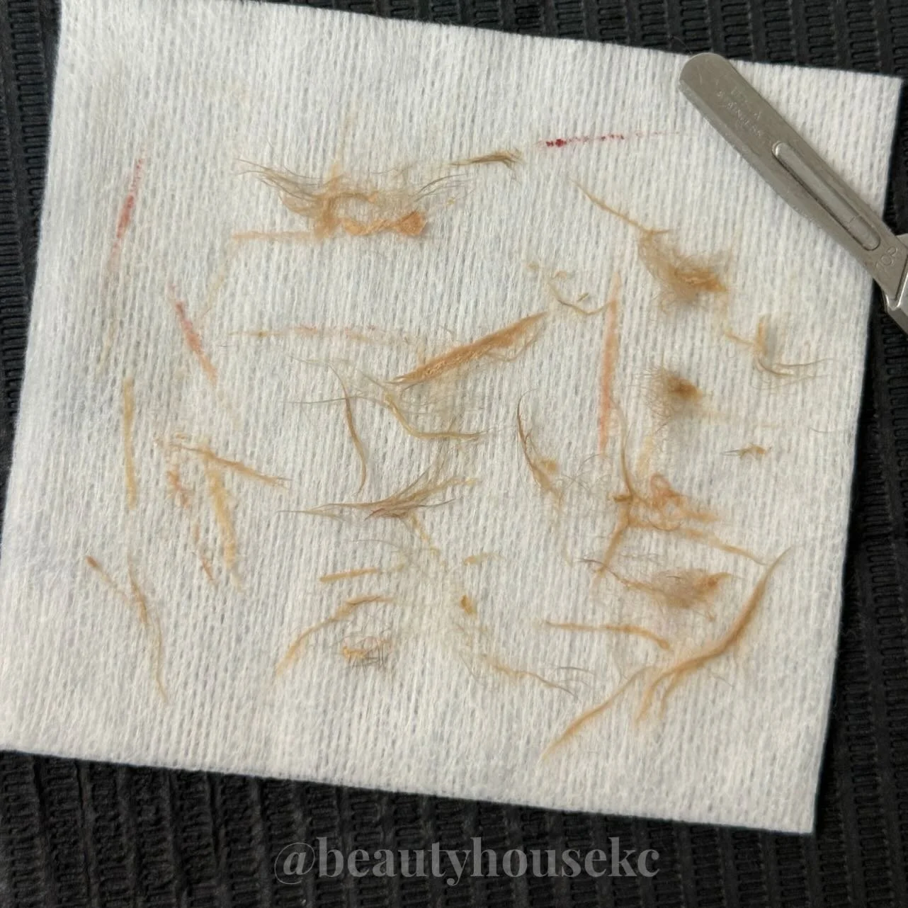 This is your sign to book a dermaplane facial ✨

Look at everything that comes off your skin&hellip; dead skin, peach fuzz, buildup you didn&rsquo;t even realize was there.

And what you&rsquo;re left with?
✔️ Smooth, fresh skin
✔️ Makeup that goes o