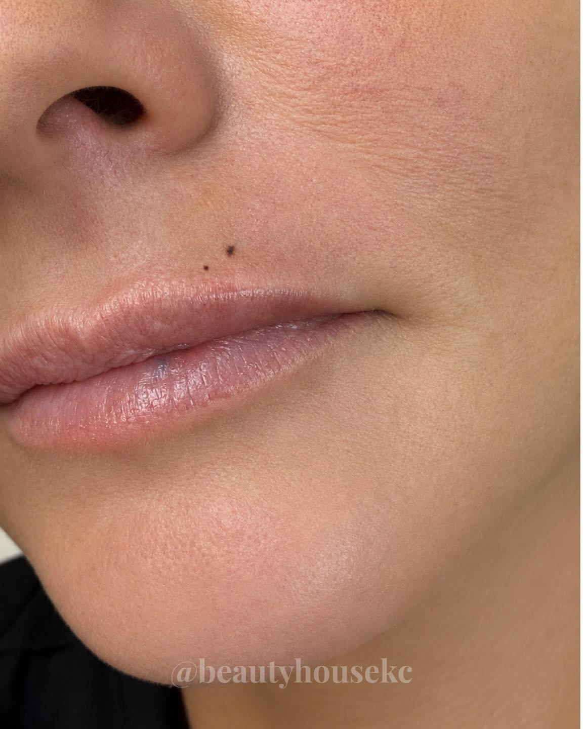 POV: your beauty marks faded over the years and you miss them ✨

This client wanted hers back exactly where they belonged 🤍 A subtle little detail that made a big difference in bringing her confidence back.

Permanent makeup isn&rsquo;t always brows