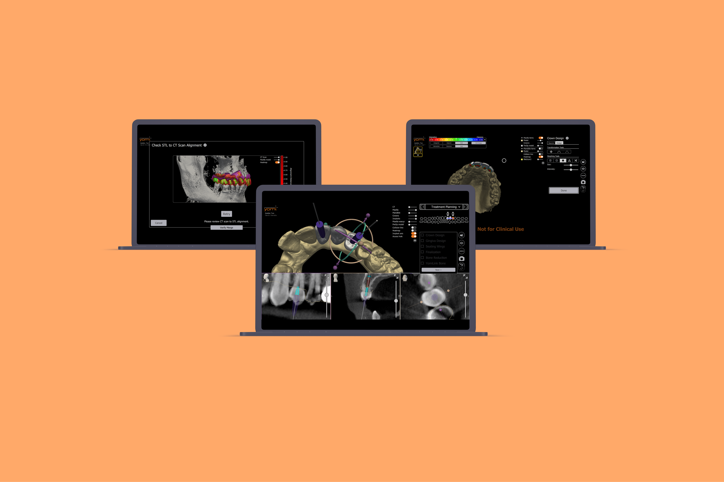 YomiPlan - Restorative Module