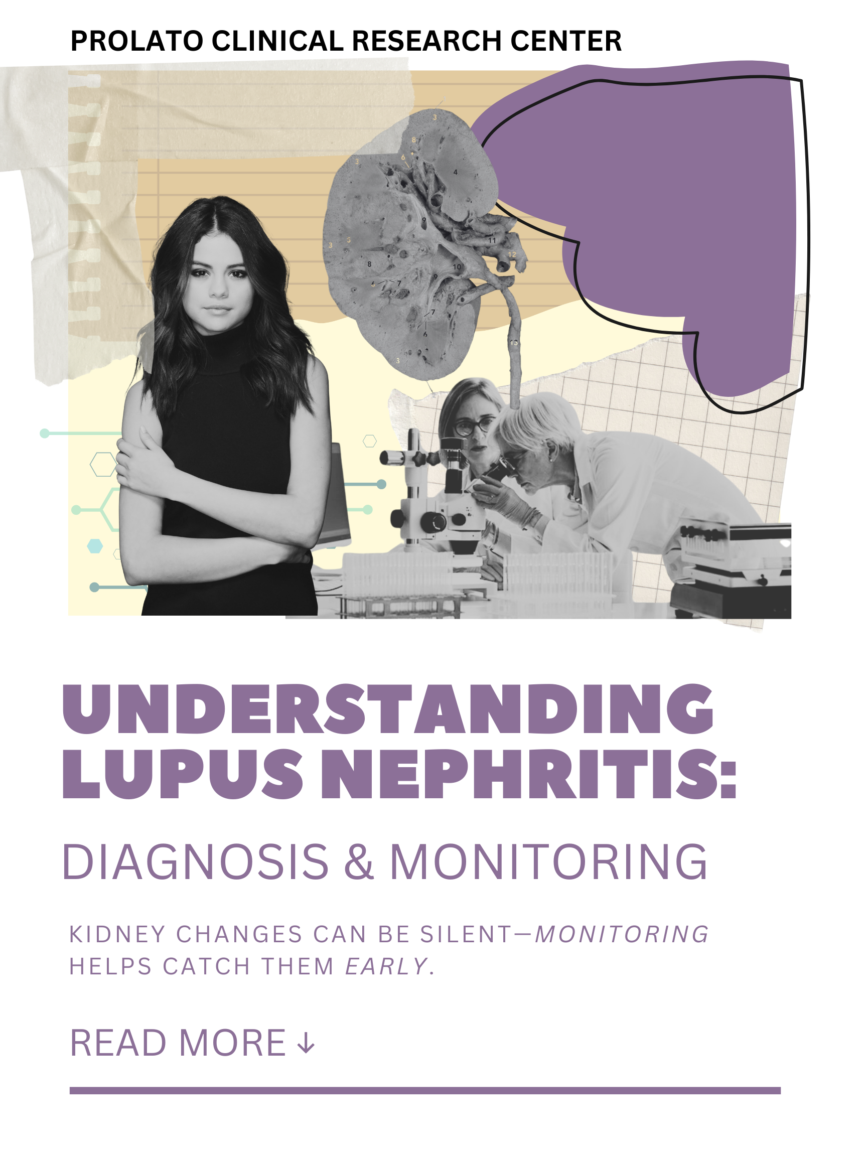 Lupus Nephritis: How It’s Diagnosed and Monitored