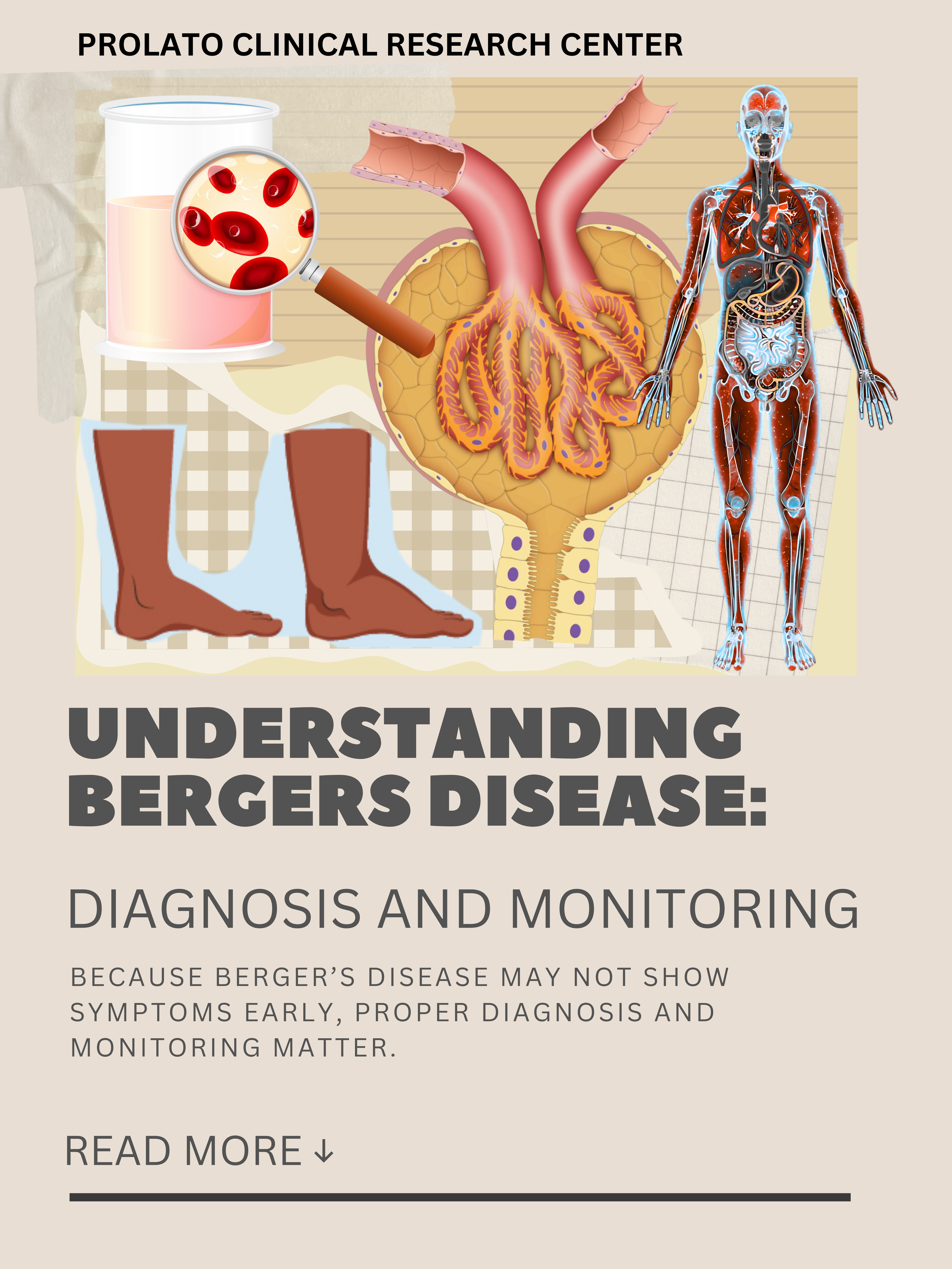 IgA Nephropathy: The Clogged Filter