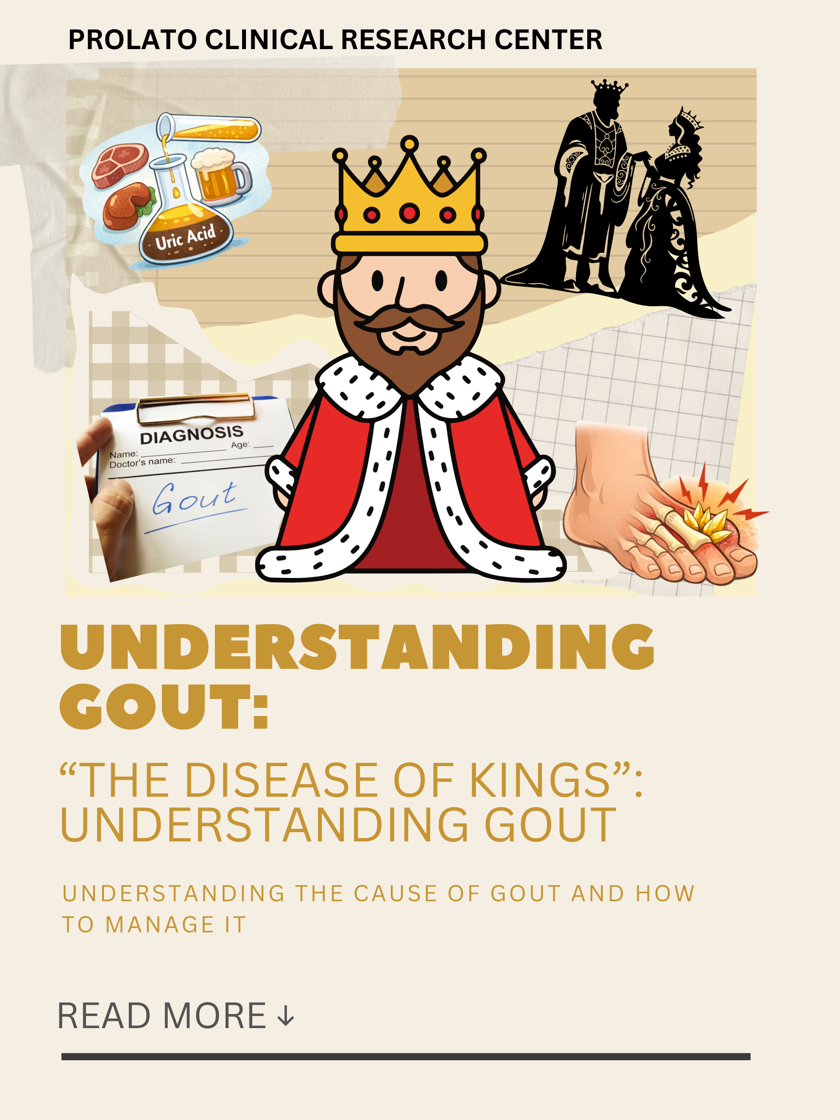 When Uric Acid Strikes: Understanding the Sudden Pain of Gout