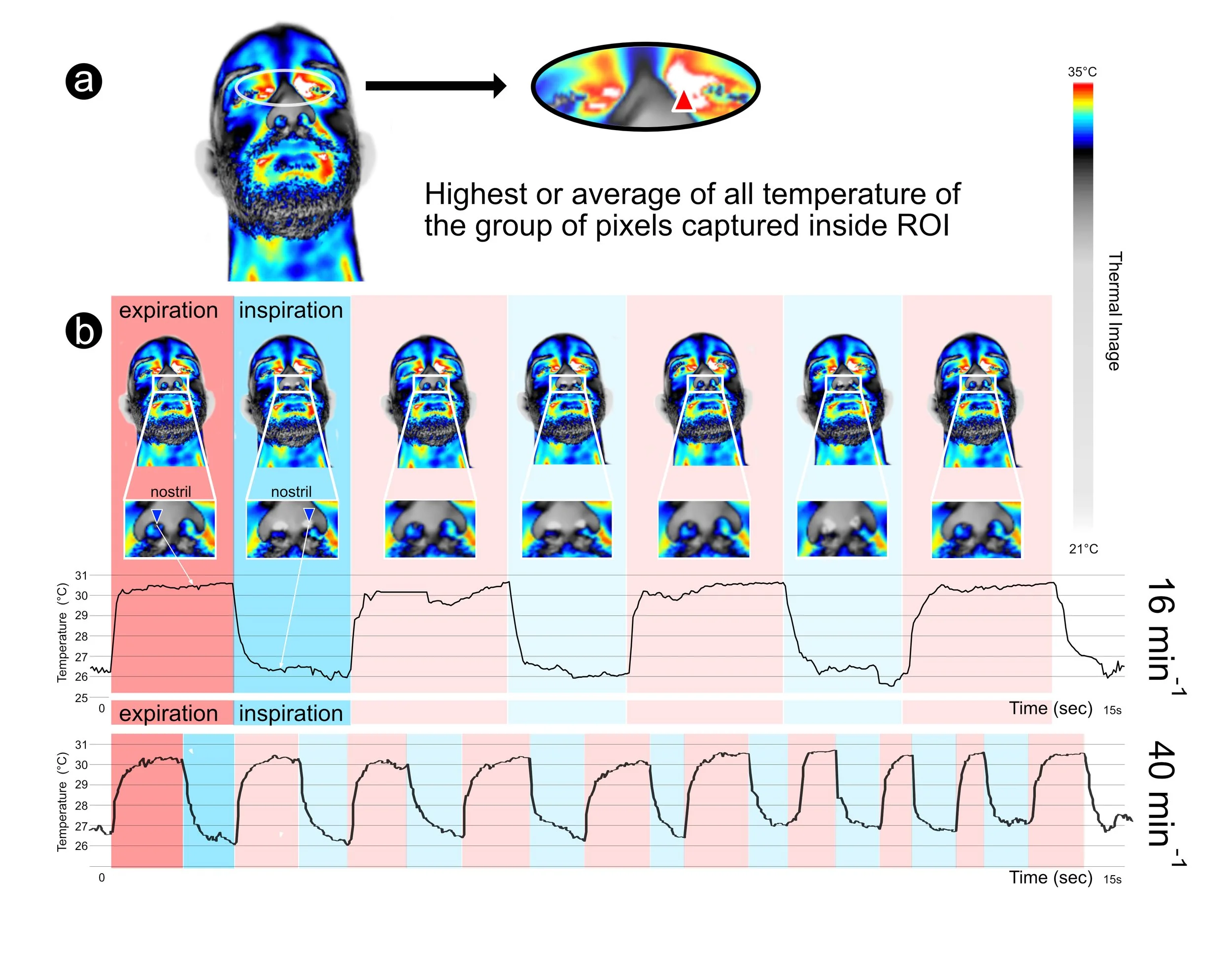 Artigo publicado na Temperature (IF 4,69) mostrando a estimativa de frequência respiratória durante pandemia de Covid 19 utilizando a imagem térmica da face em centro de emergência.