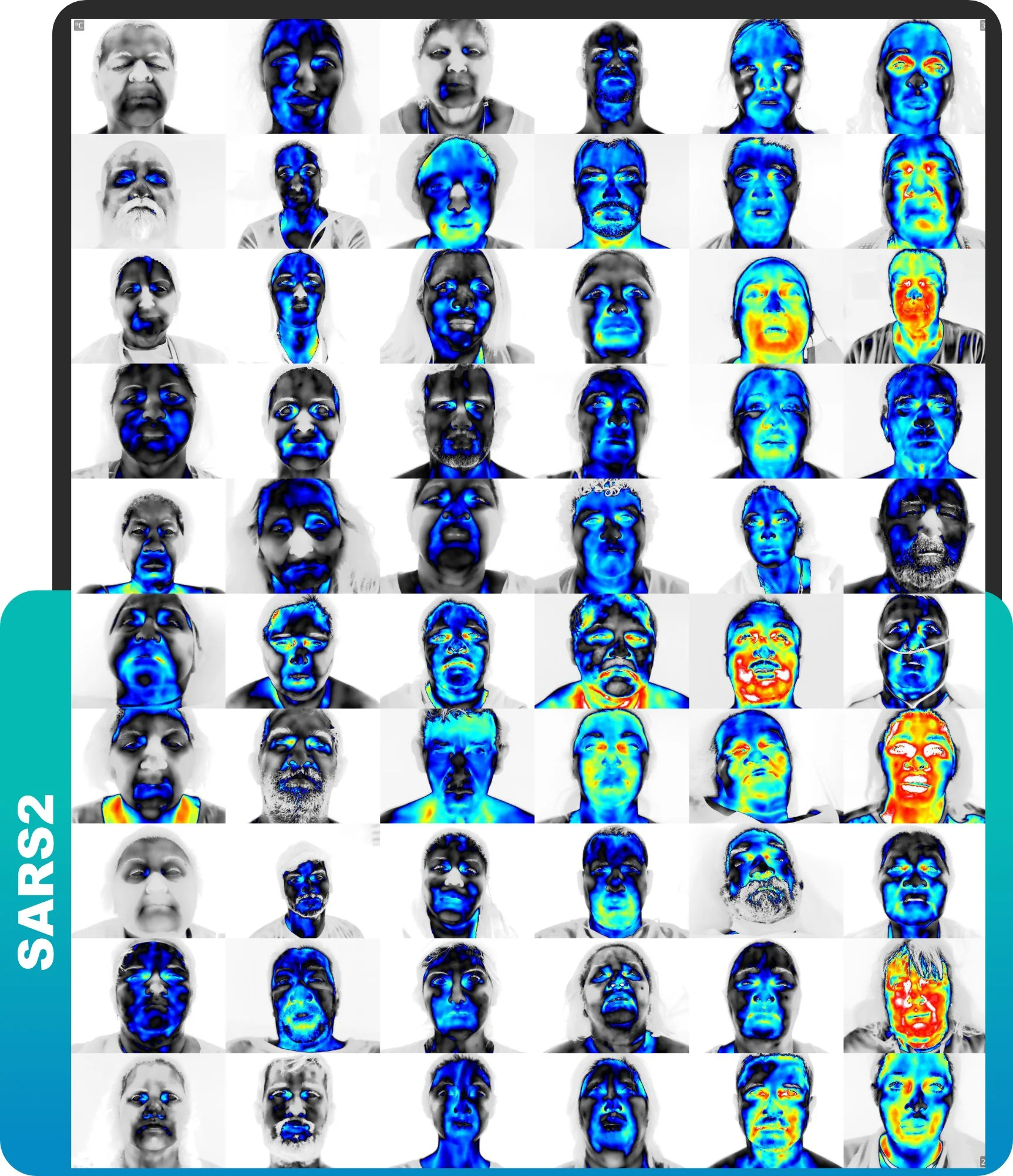 Mais 1 artigo!!! Primeiro estudo associando a imagem térmica da face e Covid 19, e a Predikta publicou na PlosONE (IF 3.752)