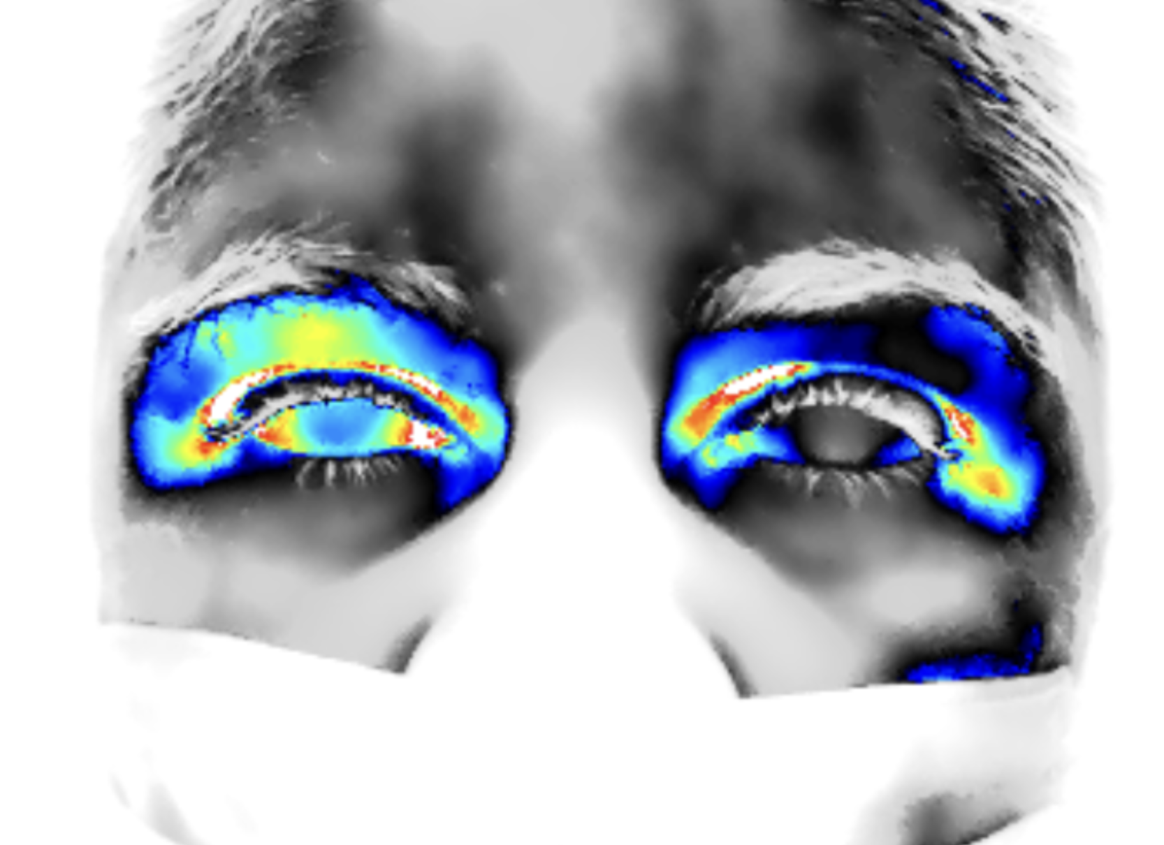 Visão além do alcance: a termografia no tratamento de doenças oftalmológicas.