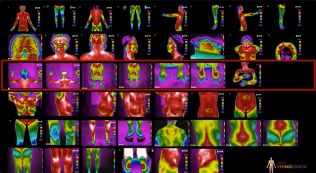Imagem de varredura térmica corporal com múltiplas visualizações, destacando diferentes áreas do corpo humano com cores que indicam temperatura, sendo destaque uma linha vermelha ao redor de uma seção central.