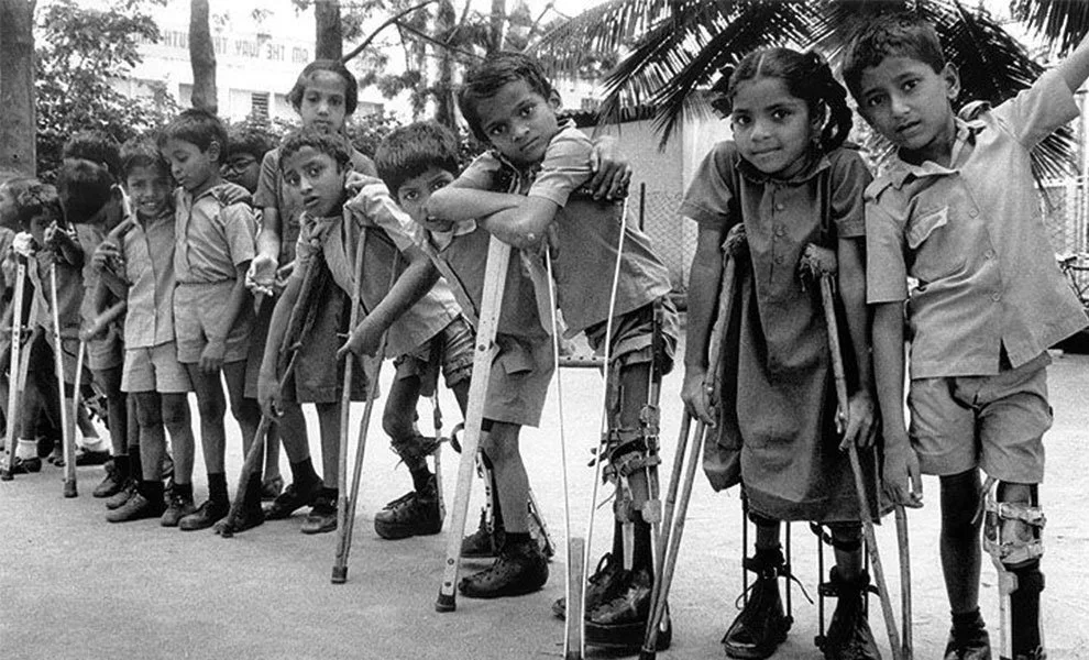 child polio patients
