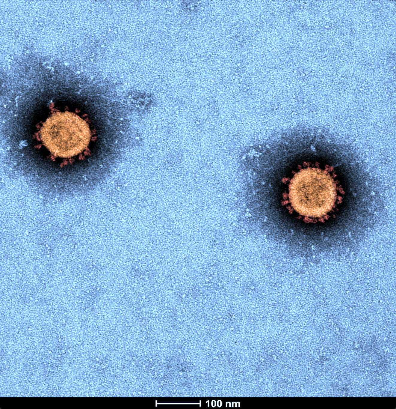 Image of SARS-COV-2 virus taken by Dr Jason Roberts with an Electron Microscope, The Peter Doherty Institute, University of Melbourne