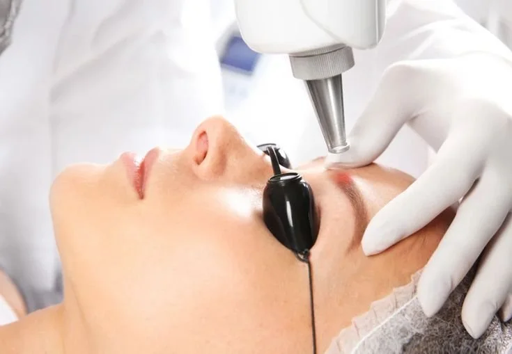 Person undergoing laser skin treatment wearing protective eye goggles