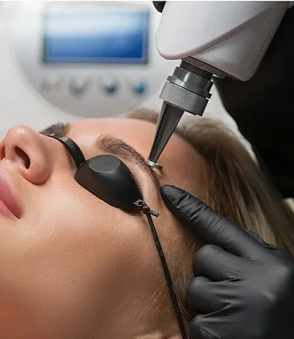 Person receiving laser treatment on eyebrow with protective goggles