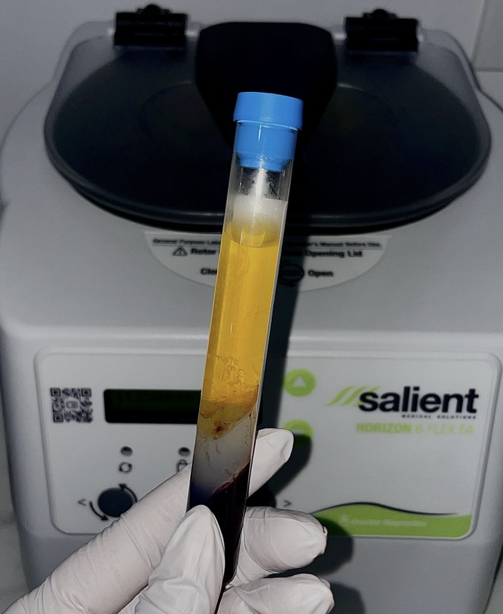 A gloved hand holding a test tube with separated blood components in front of a centrifuge.