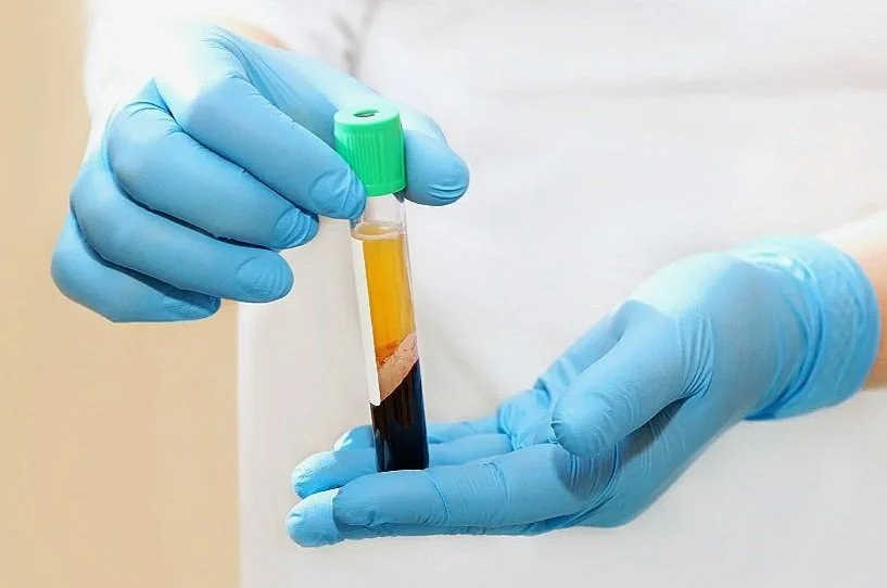 Gloved hands holding blood sample in test tube