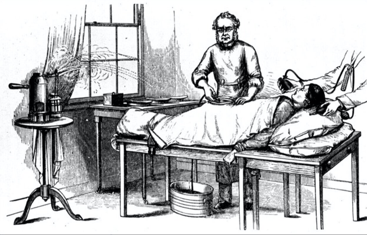 Doctor performing ovariotomy, London, 1882.