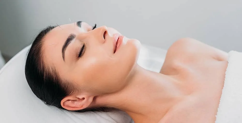 Should You Try Facial Acupuncture What is Cosmetic Acupuncture — West