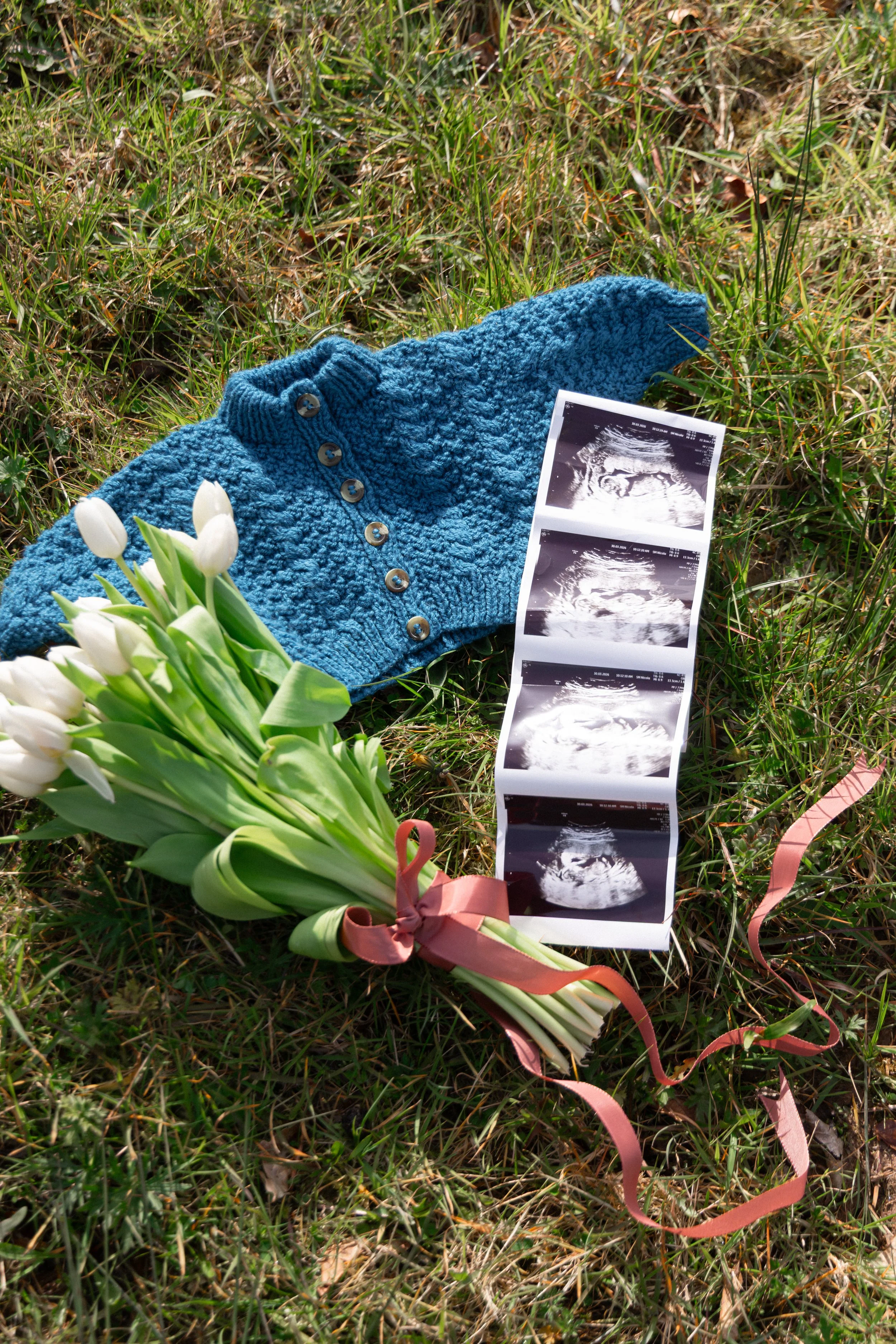EmilySercombePhotographyBangorNorthernIrelandPregnancyShoot-52.JPG