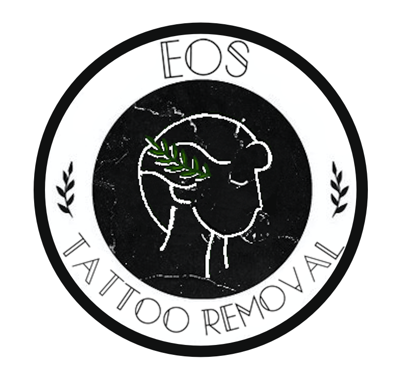 EOS Tattoo Removal