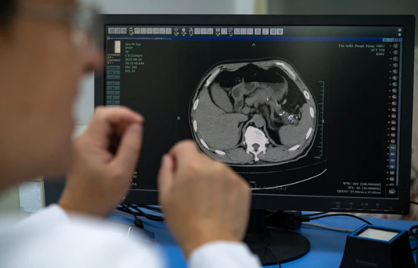 Trung Cộng quyết liệt đưa AI vào chẩn đoán bệnh