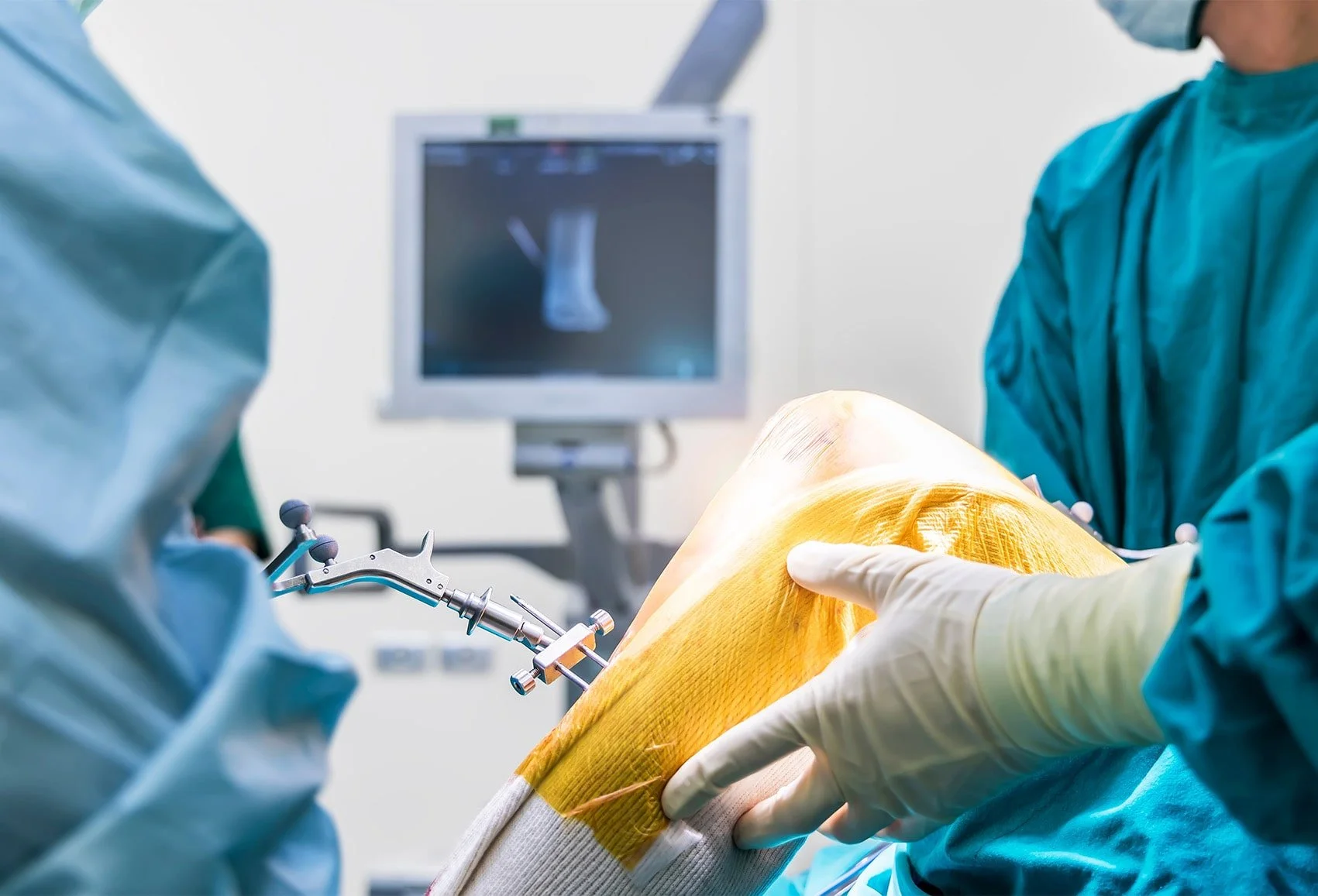 Traditional vs. Robotic Knee Replacement Compared