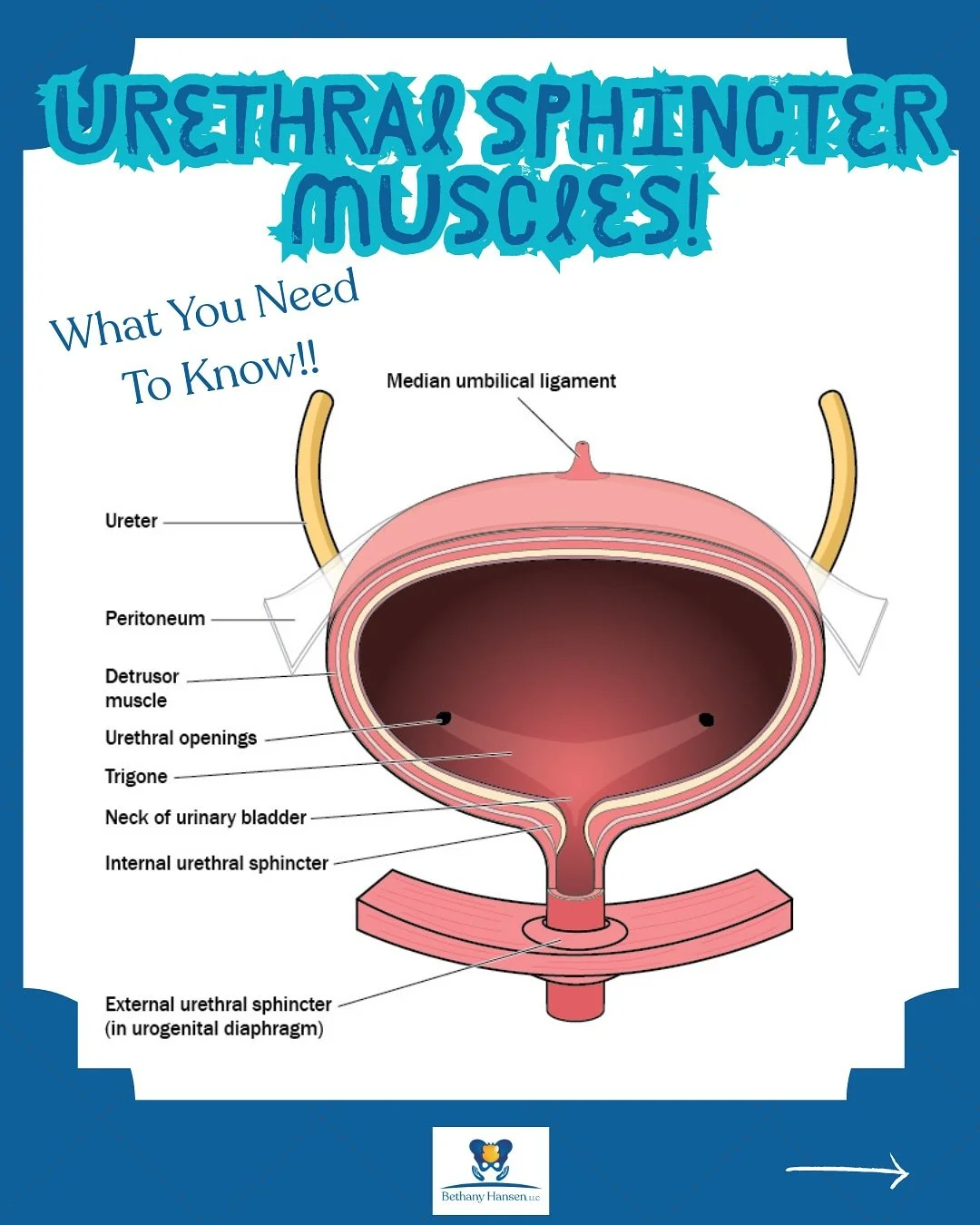 Urethral Sphincter Muscles! 

In one study by Falah-Hassani et al in 2021, they concluded:

&ldquo;Maximum urethral closure pressure was the strongest determinant of SUI&rdquo; 

Aka: although we can&rsquo;t change urethral hypermobility due to fasci