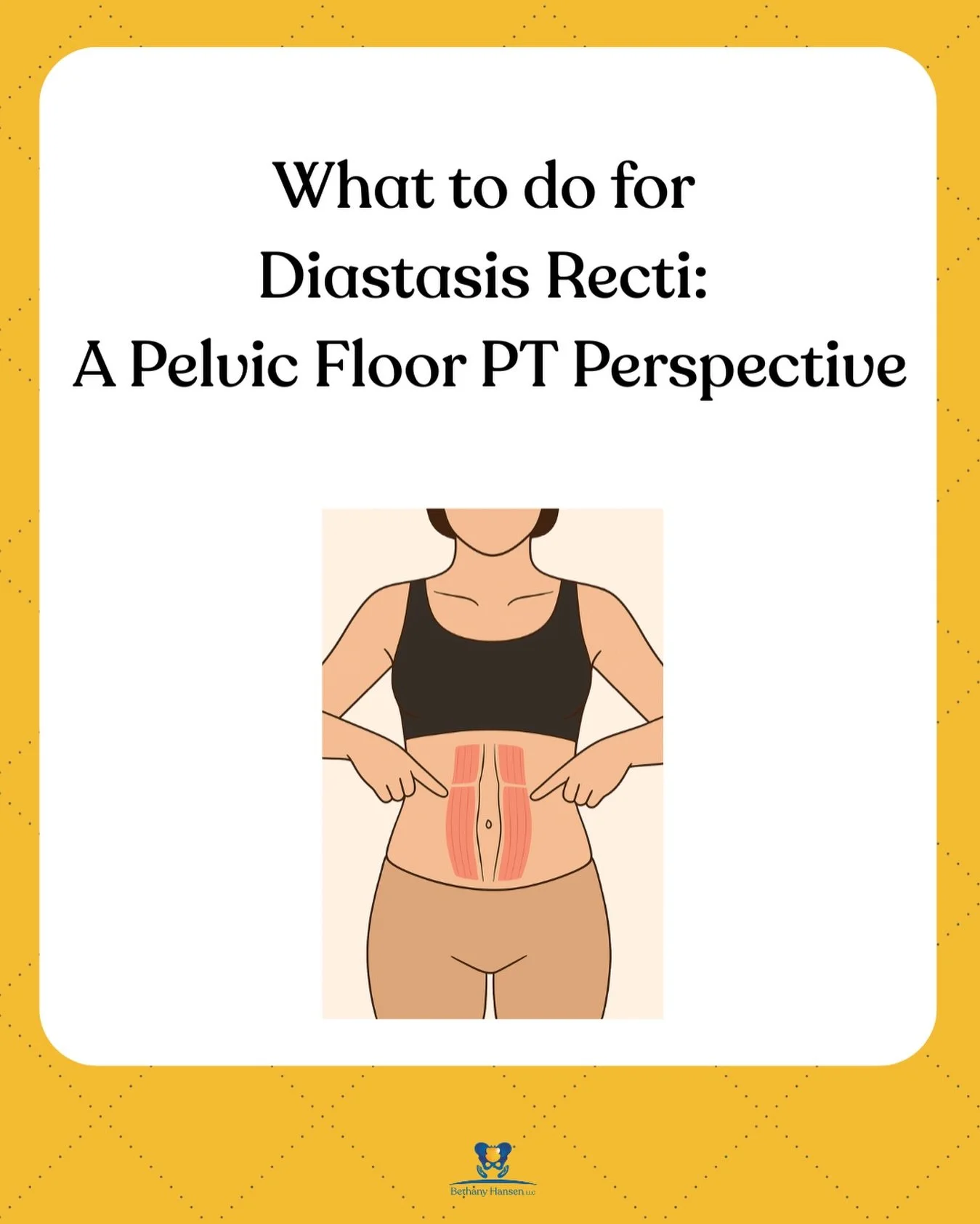 If you&rsquo;ve been told to avoid crunches forever or that your &ldquo;gap must close&rdquo; before you can do the exercise you love to do 😳 &mdash; this one&rsquo;s for you. 

Diastasis Recti (DRA) is a NORMAL, expected tissue adaptation during pr