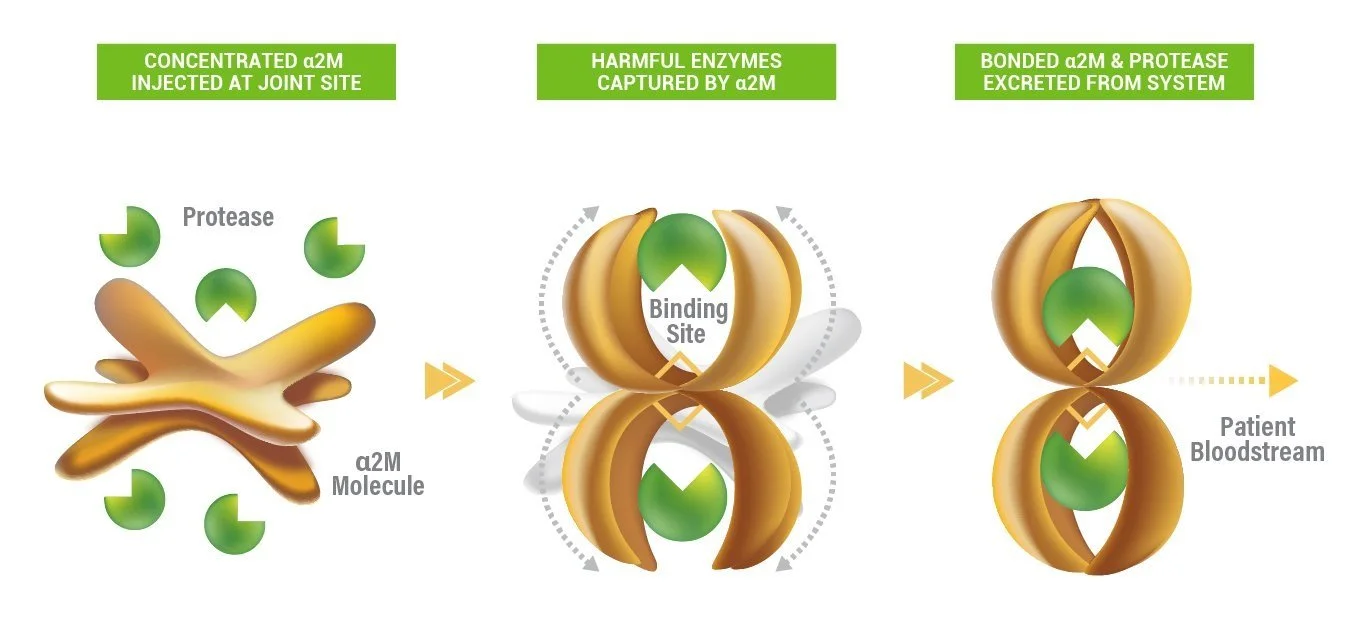 Joint Rejuvenation Therapy — Buckeye Physical Medicine & Rehab