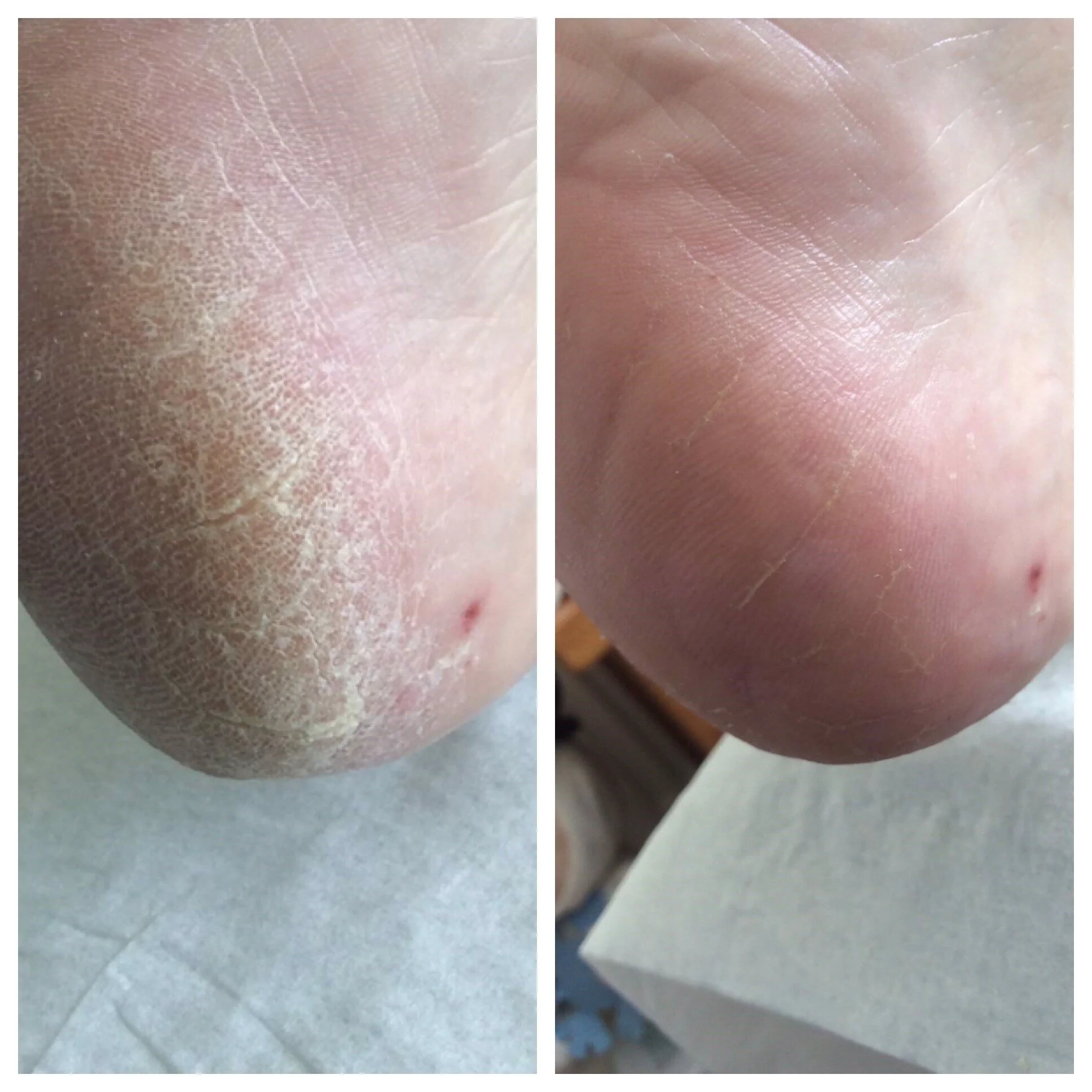 Before-after-01.jpg