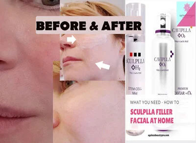 beforeafter-small.jpg