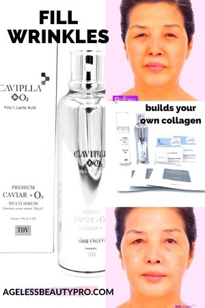 Microcurrent and RF at-home devices for skin tightening and rejuvenation