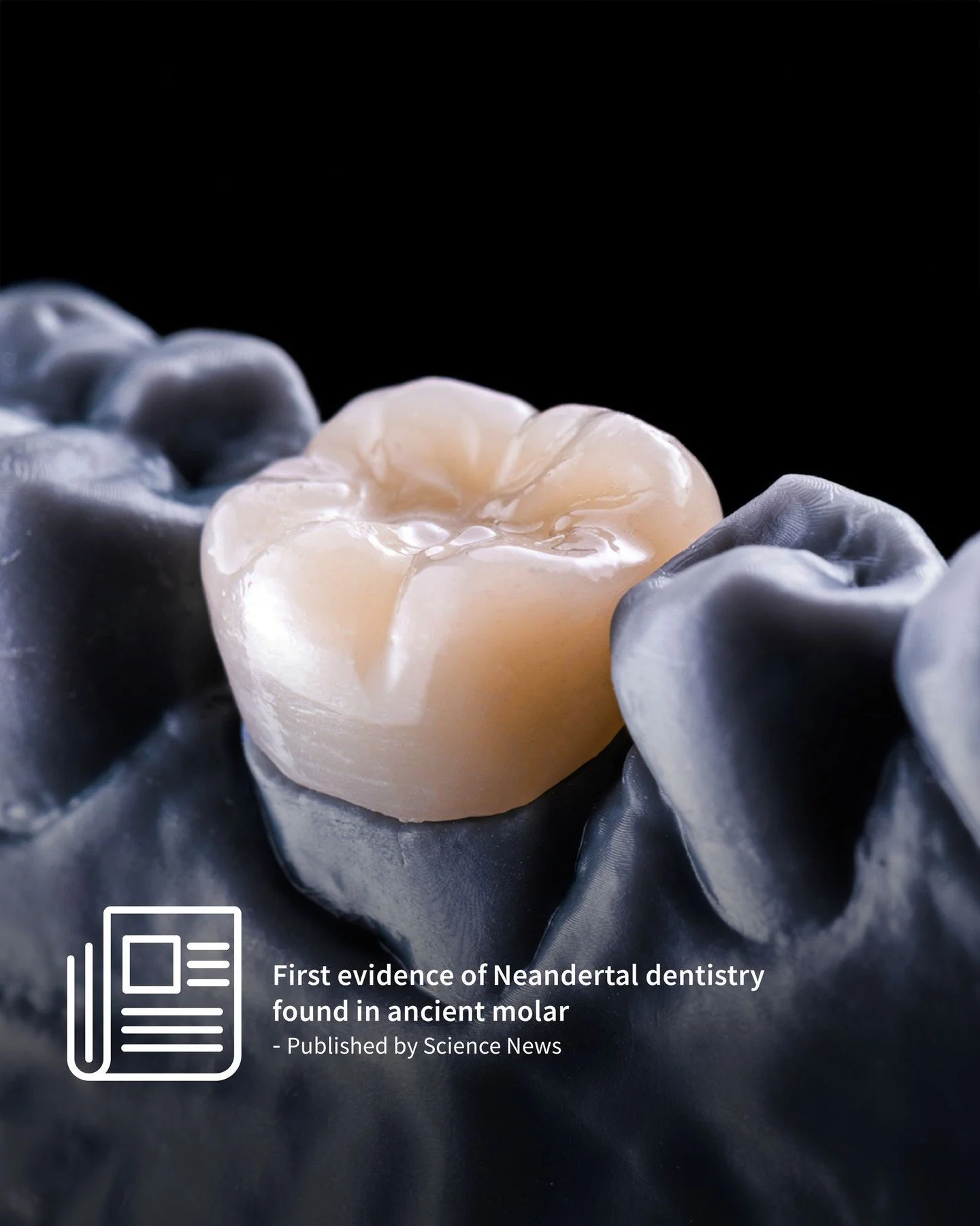 The oldest known dental procedure was just discovered: A Neandertal tooth drilled with a stone tool 59,000 years ago.

According to an article written by Tom Metcalfe published by Science News on May 13, 2026, the recently discovered molar is now con