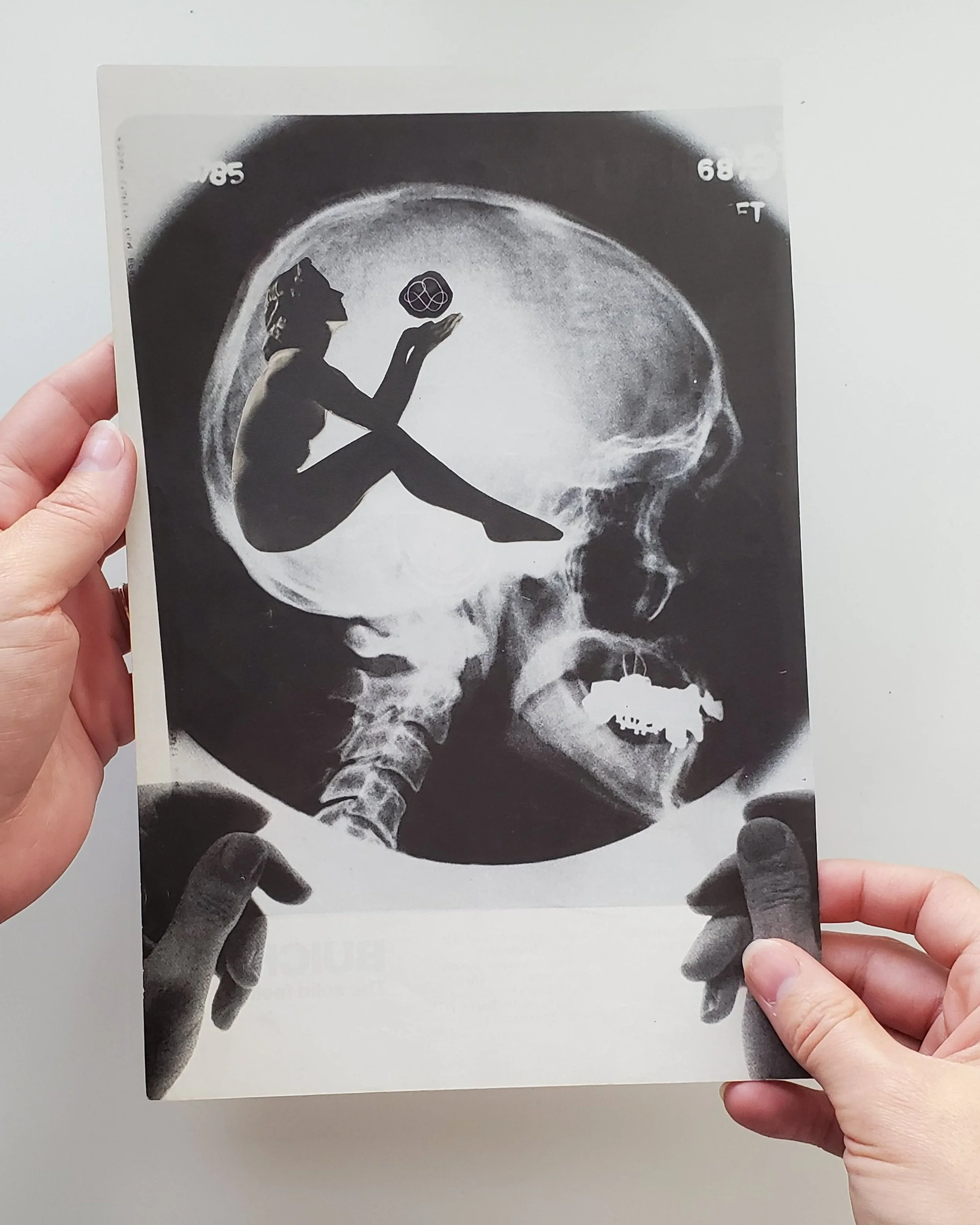 Xray+Thoughts+Detail+1.jpg