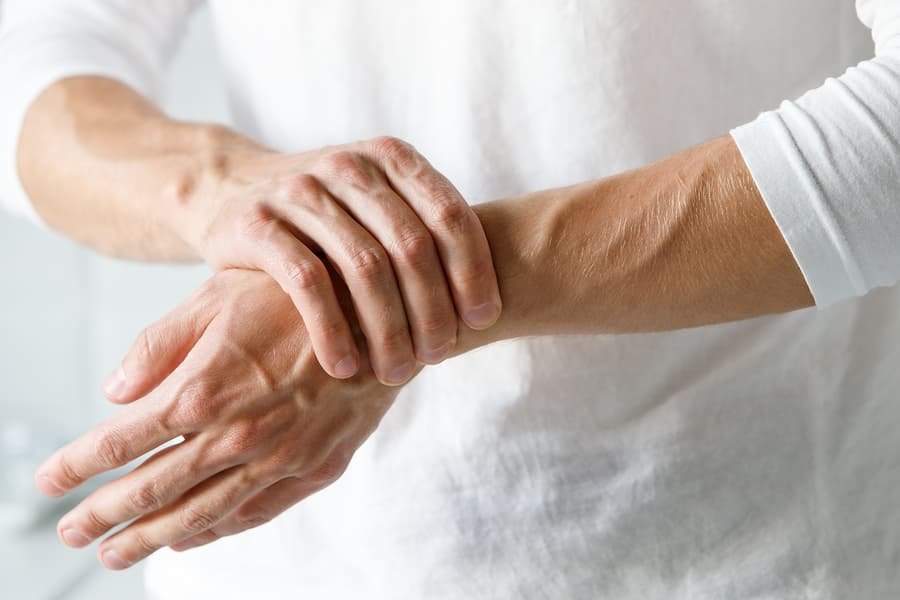 Carpal Tunnel Syndrome and the Role of Physiotherapy in Recovery